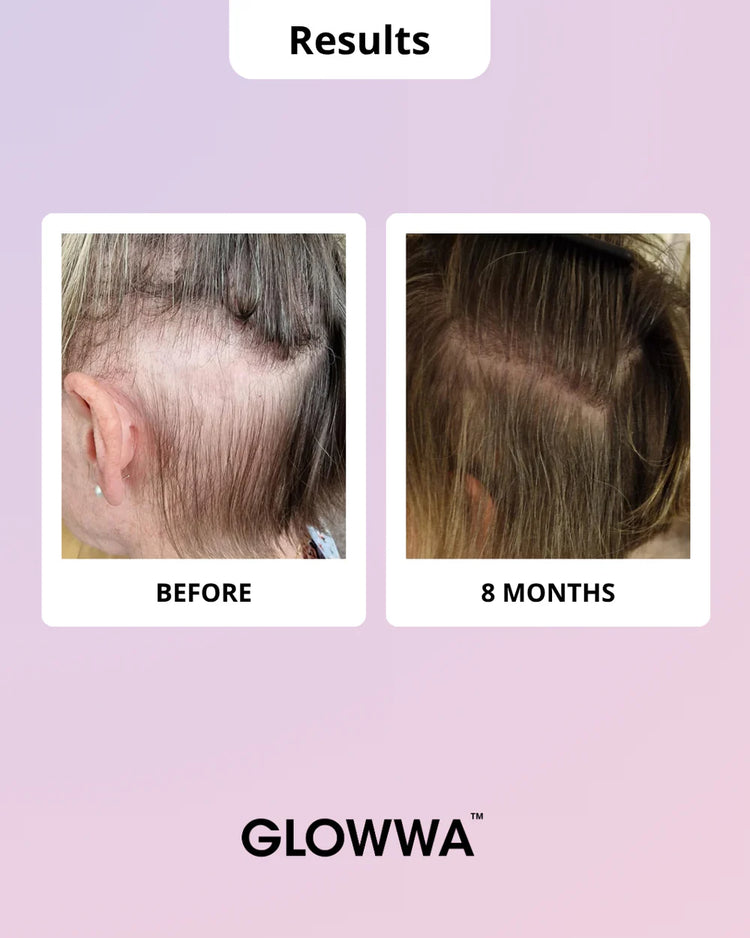 GLOWWA HAIR FOOD™ MENO