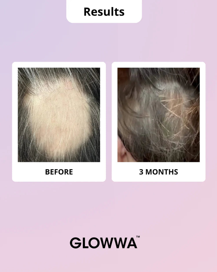 GLOWWA HAIR FOOD™ MENO