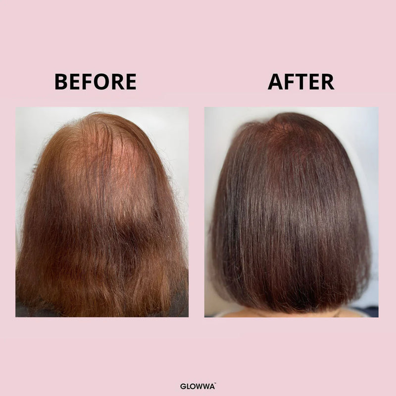 GLOWWA HAIR FOOD™