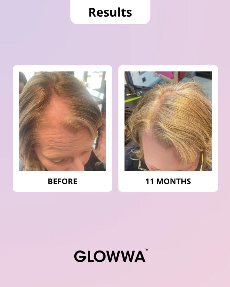 GLOWWA HAIR FOOD™ MENO